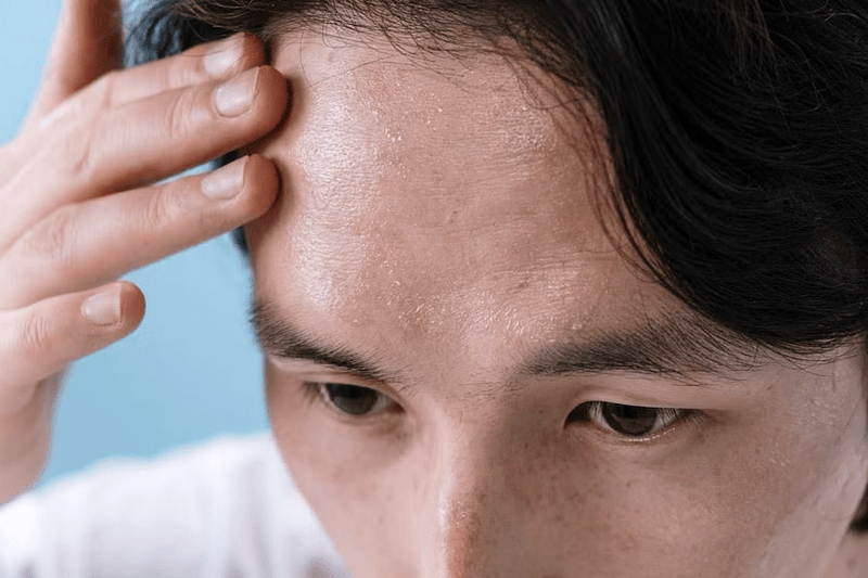 Skin Deep: Unraveling the Intricate Connection Between Emotions and Skin Health - bearpo.